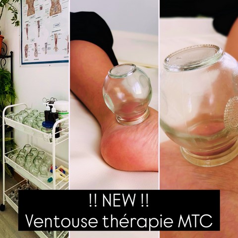 Ventouses thérapie MTC Ventouses thérapie MTC